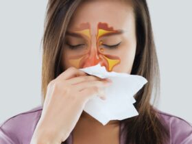 Remedies for Sinus Relief