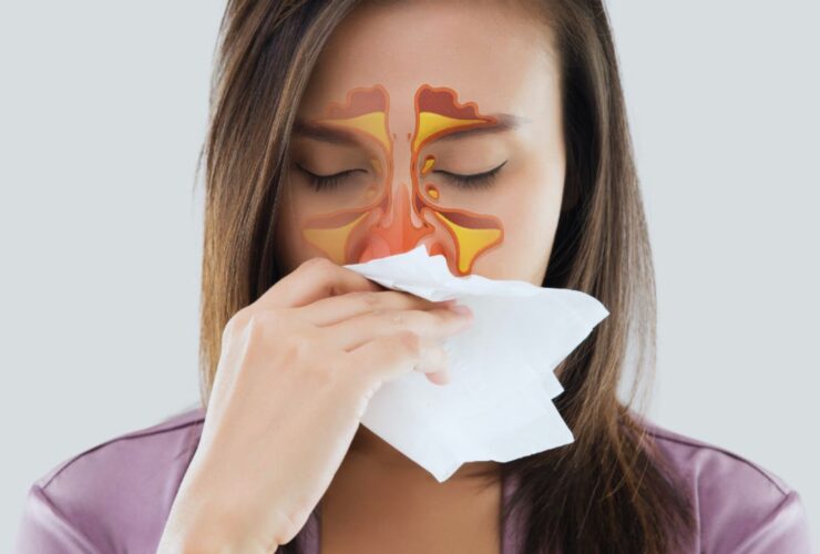 Remedies for Sinus Relief